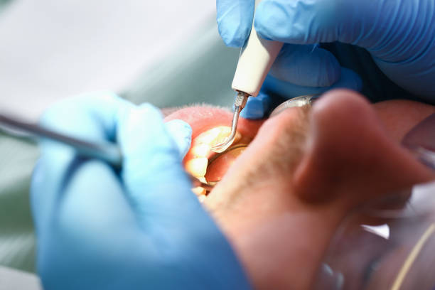 Best Emergency Dentist for Knocked-Out Tooth in West Crossett, AR